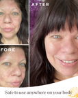 Eczema Easy Glide Stick