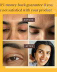 Eczema Easy Glide Stick