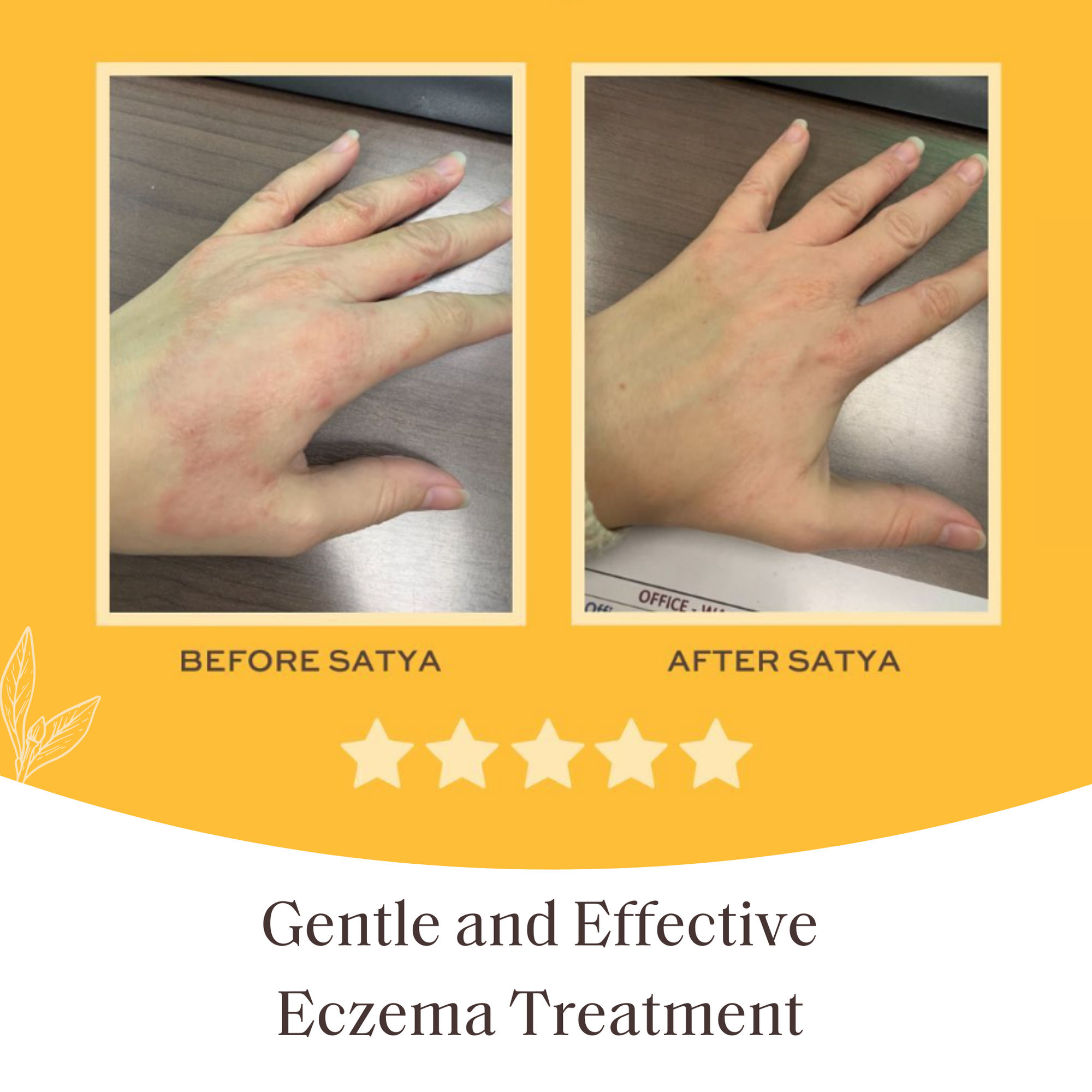 Eczema Jar - 2 Pack