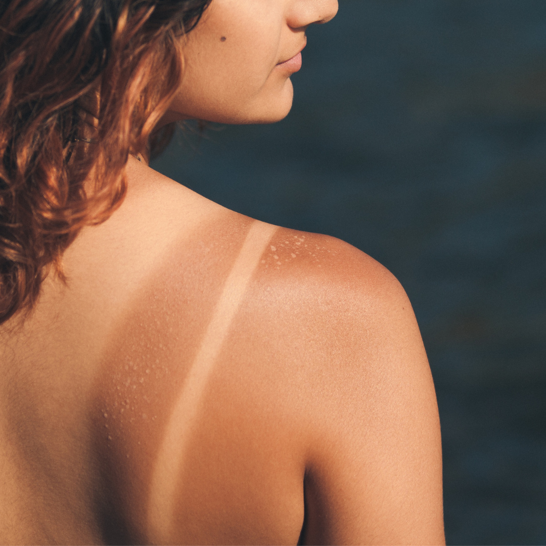 6 Sunscreen Tips for Healthy, Resilient Skin